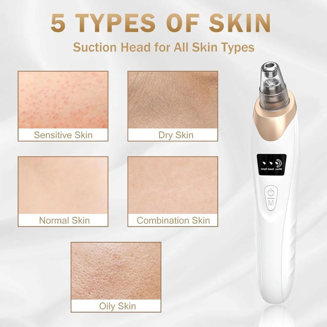 Elurelia™ PoreSonic Blackhead Remover